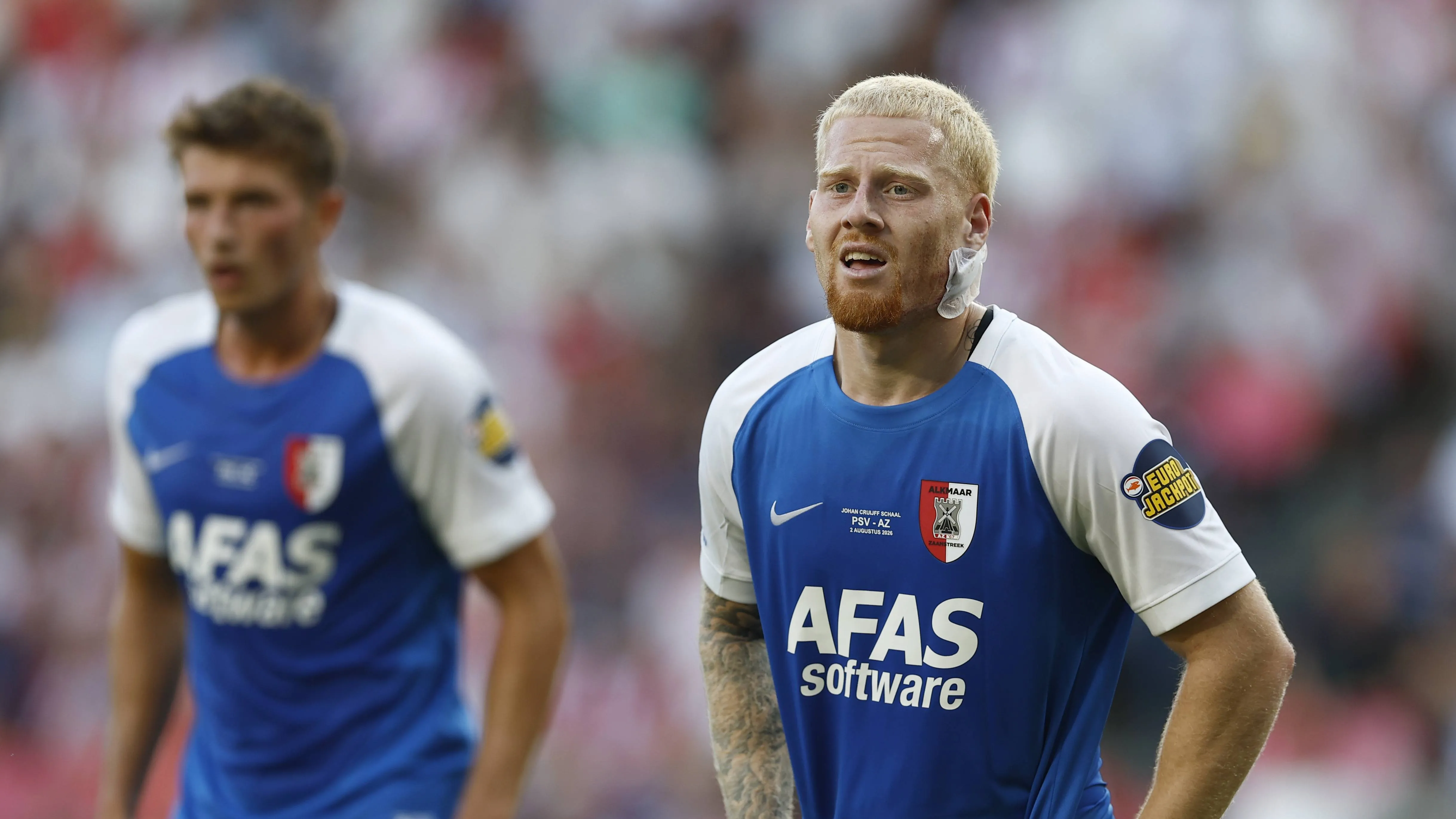梅尔丁克耳部遭踢险失耳,赛后笑称已缝好,AZ 4-0 大胜 PSV